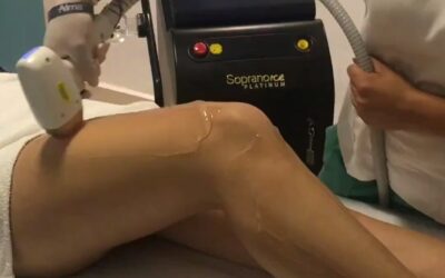 Contamos con equipo Soprano Ice Platinum Propio para las sesiones